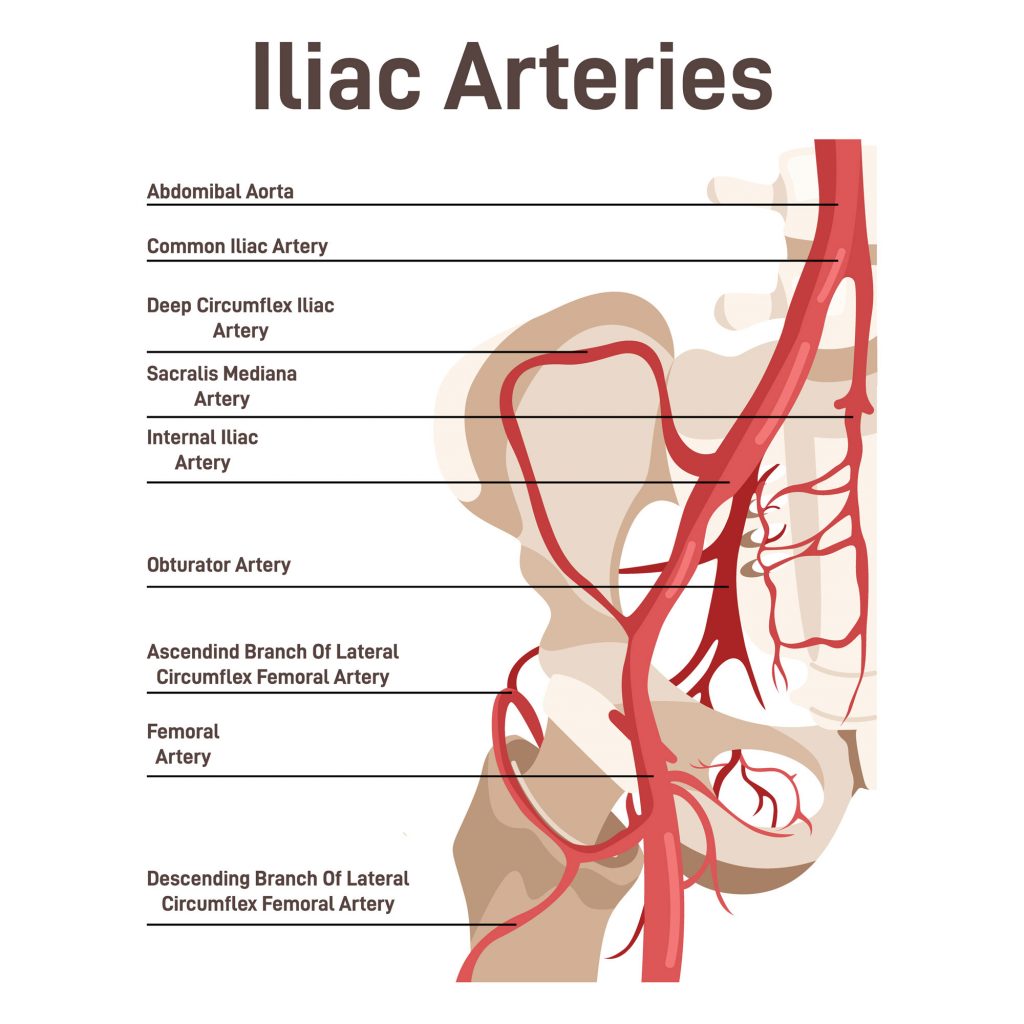 Common Iliac Vein